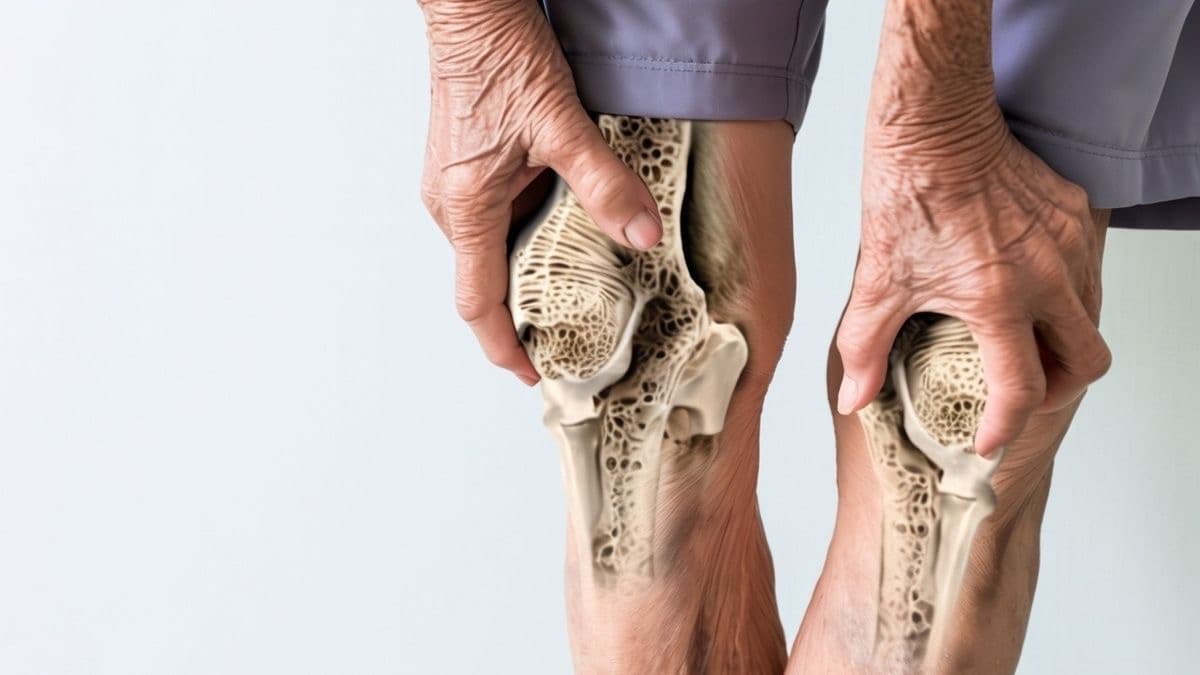 Lutut Bunyi "Krek"? Belum Tentu Osteoporosis | Kita Sehat